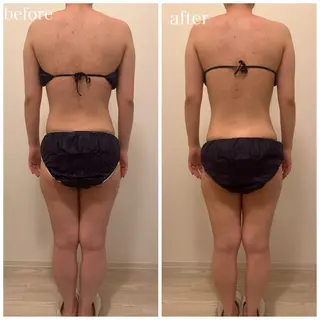 23beauty所属・武藤 那月のエステ・リラクイメージ