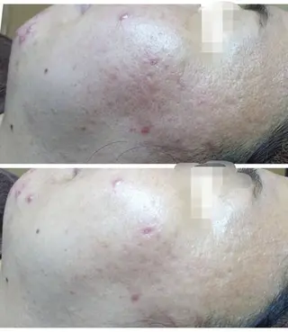 EYE LASH LAPISのエステ・リラクイメージ