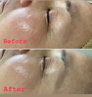 セミロング パーマ ヘアアレンジ メンズ キッズ ネイル マツエク・マツパ アイブロウ 毛穴，ニキビ跡 改善総合サロンのその他イメージ