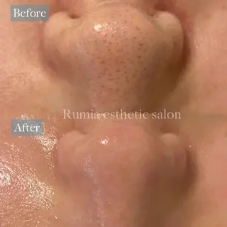 Rumia Salonのエステ・リラクイメージ