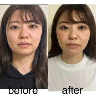 美容鍼灸サロン mahoroba院長のエステ・リラクイメージ