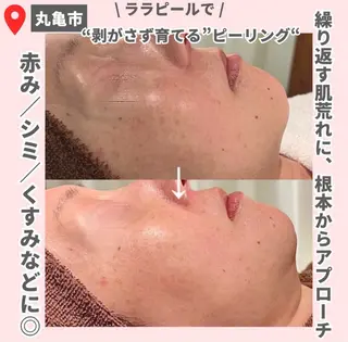 前山 くるみのエステ・リラクイメージ