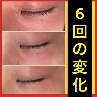 学生ニキビ改善🍀 優しい肌質改善のエステ・リラクイメージ