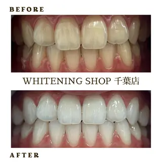 メンズ ホワイトニング ショップ千葉店のその他イメージ