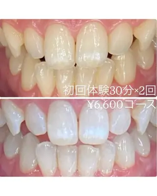 メンズ ホワイトニングルーム 川崎店所属・ホワイトニング ルーム 川崎店のその他イメージ