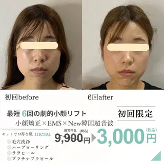 最速小顔・肌質管理 ❣️エスポワールのエステ・リラクイメージ