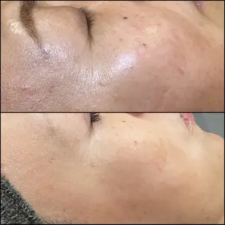 LiZA エステティックサロンのエステ・リラクイメージ