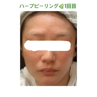 soposilma 🦋Lisaのエステ・リラクイメージ