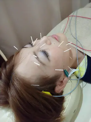 お顔のむくみたるみ 専門☆美容鍼小顔矯正のエステ・リラクイメージ