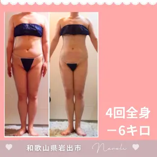 温活beautyサロンNeroli所属・切らない脂肪吸引🔥 Neroliまりこのエステ・リラクイメージ
