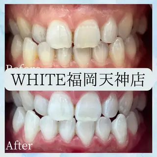 メンズ ホワイトニング専門店 WHITE天神店のエステ・リラクイメージ