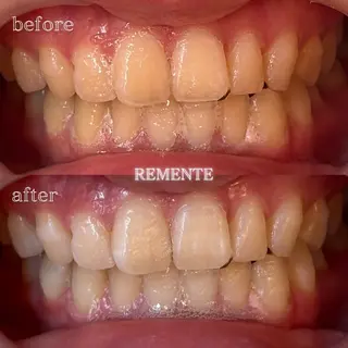 CHARMER韓国式美肌サロン所属・CHARMER🌹 Naokoの眉毛・アイブロウイメージ