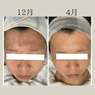 DeI'm   名古屋栄所属・小林 玲菜のエステ・リラクイメージ