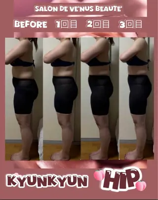 ヴィーナス ビューティーのエステ・リラクイメージ