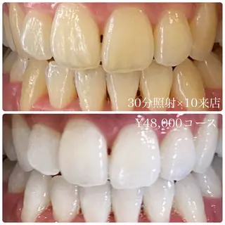 PLATINUM Beauty 横浜店所属・ホワイトニングルーム 横浜店のその他イメージ