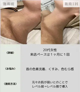 脱毛・眉毛・フェイス サロンN久留米店のその他イメージ