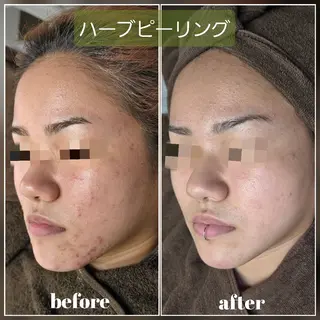facial salon Lily所属・salon Lilyのエステ・リラクイメージ