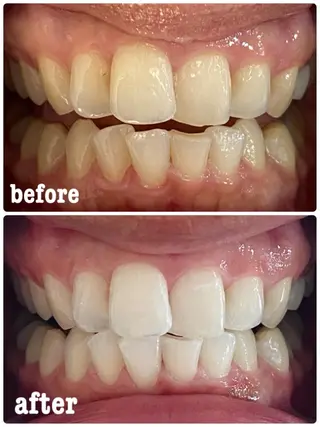 ホワイトニングサロン ラウレアのその他イメージ