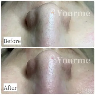 毛穴ケア専門サロン Yourmeユアミーのエステ・リラクイメージ