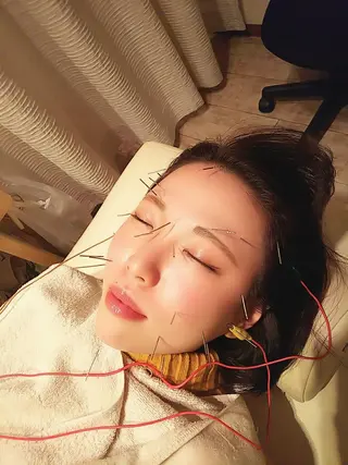 むくみたるみ専門☆ 美容鍼・小顔矯正のエステ・リラクイメージ