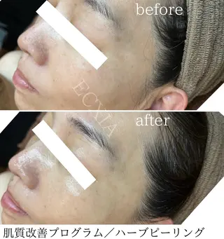 ECXIA 【エクシア】のエステ・リラクイメージ