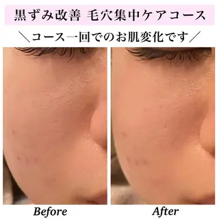 Bellesthe (ベルエステ)のエステ・リラクイメージ