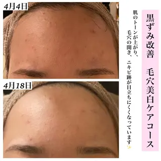 Bellesthe (ベルエステ)のエステ・リラクイメージ