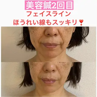 美容鍼灸師 齋藤 麗子のエステ・リラクイメージ