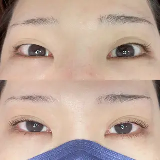 ใใใจใฏใปใใใ ๐๐ผ๐๐๐ ๐๐ธ๐โใฎใใใจใฏใปใใใใใถใคใณ