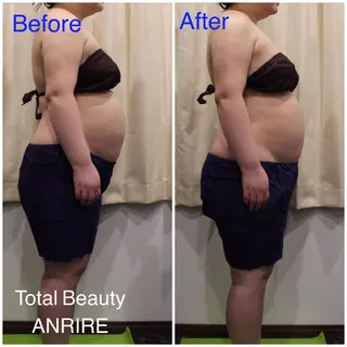 ANRIRE (アンリール)のエステ・リラクイメージ