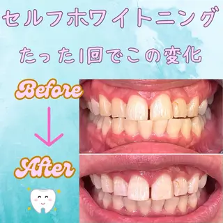 メンズ soerute所属・オーラルケアサロン soeruteのその他イメージ