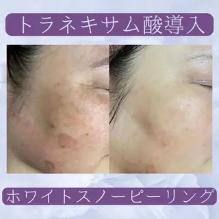 ココルアナ橋本店所属・ココルアナ 橋本店のエステ・リラクイメージ