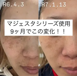 Shiny所属・✨ナリス化粧品✨ Shinyのエステ・リラクイメージ