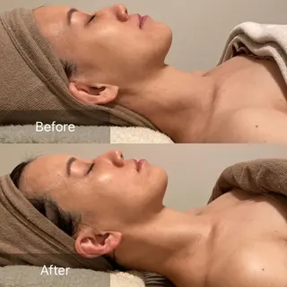 Ｂ&H所属・頭痛•肩こり専門/ 眉サロンB&H心斎橋のエステ・リラクイメージ