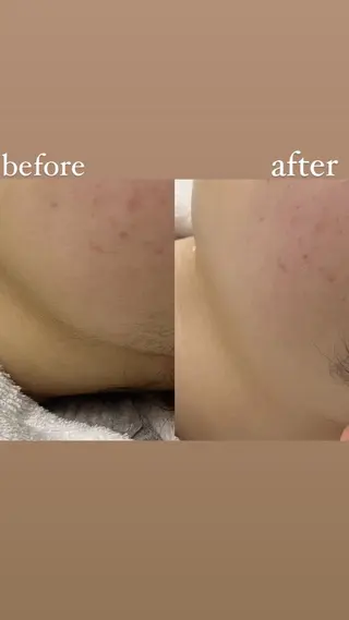 女性専門お顔剃り sunraineのエステ・リラクイメージ