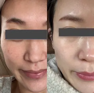 韓国🇰🇷価格 サロン_Nbibiのエステ・リラクイメージ