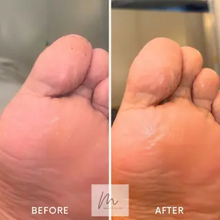 SHARES MADOKAのエステ・リラクイメージ