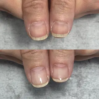 ネイル 埼玉県ちび爪専門店｜ 自爪育成｜朝霞市のネイルデザイン