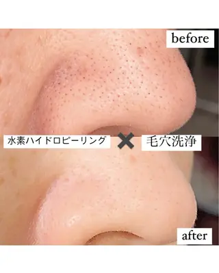 Moana【モアナ】 KARIN🫧のエステ・リラクイメージ