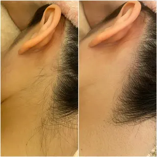 ✨美肌水光✨ アトリエリュバンのエステ・リラクイメージ