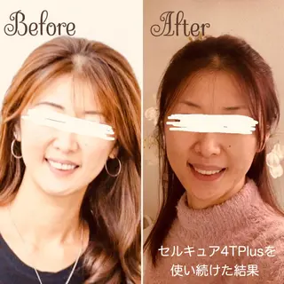 透明感の肌Lino malieのエステ・リラクイメージ