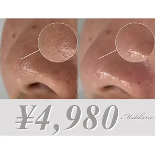 肌質管理 MIBLANC上野店のエステ・リラクイメージ