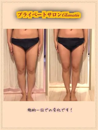 ロング カラー パーマ ヘアアレンジ メンズ キッズ ネイル マツエク・マツパ 強圧オールハンド痩身&黄土よもぎ蒸しプライベートサロンClematis池袋所属・強圧オールハンド痩身 片野のエステ・リラクイメージ