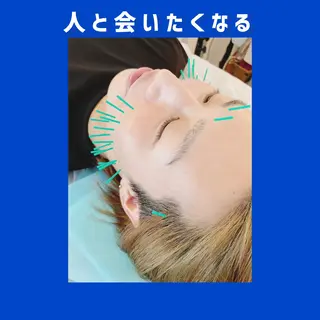 メンズ 小顔美容鍼専門サロン 渋谷YZのエステ・リラクイメージ