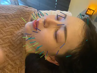 Acupuncture  salon LINOA リノア鍼灸院所属・ヘッドスパ鍼/小顔鍼 耳ツボ 　LINOAのエステ・リラクイメージ