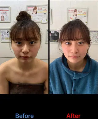 毛穴改善/脱毛 ネイル 川上久仁子のエステ・リラクイメージ