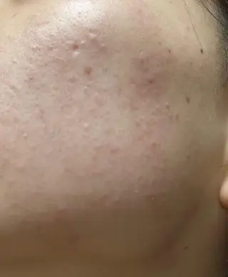 メンズ キッズ 脱毛SALON RaYNiCKのエステ・リラクイメージ