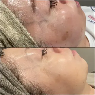 LiZA エステティックサロンのエステ・リラクイメージ