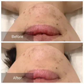 Charis エステ&ネイルのエステ・リラクイメージ