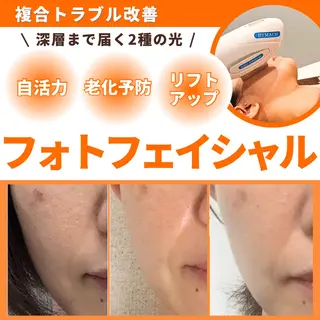 エステサロン JURISのエステ・リラクイメージ